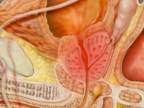 Tipo di prostata sana di una persona